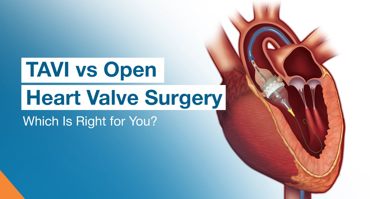 TAVI vs Open Heart Valve Surgery: Which Is Right for You?